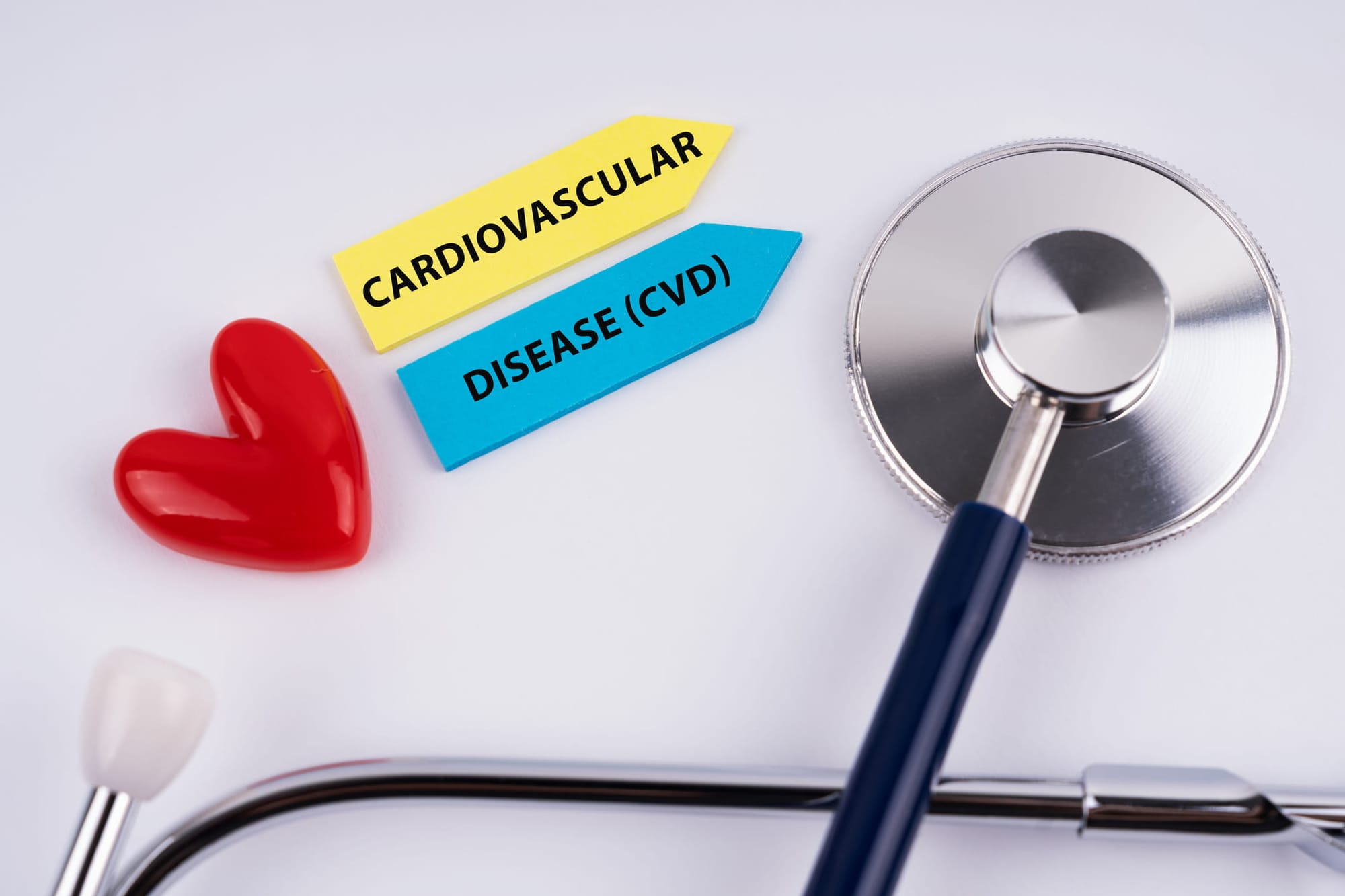 Cardiovascular disease - CVD text with stethoscope and heart shape