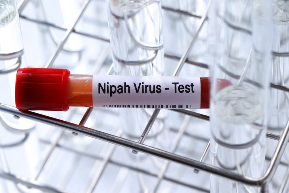 Nipah virus: New cases trigger alert, as scientists uncover how it disarms human defences post image